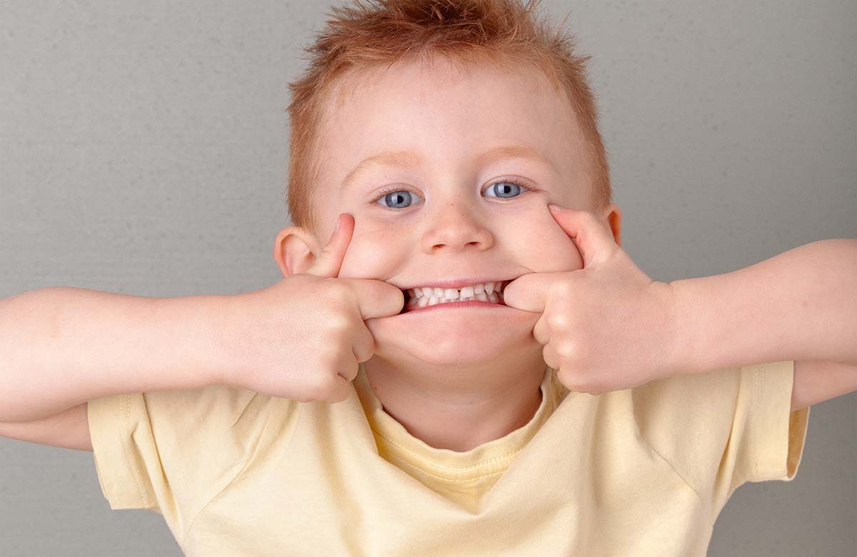 denti gialli bambini