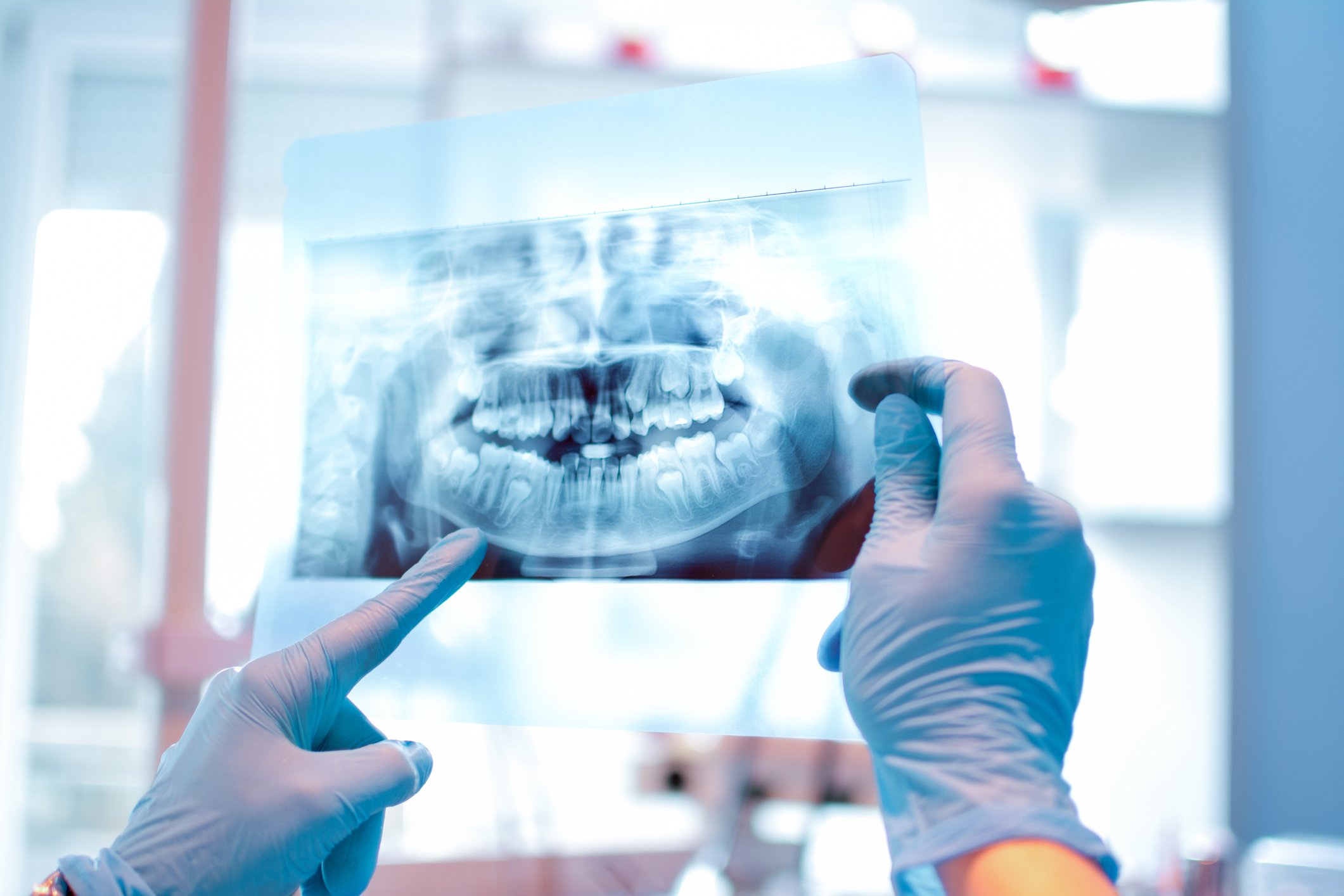 X Ray Image.