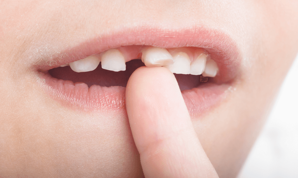 Quando Togliere I Denti Da Latte